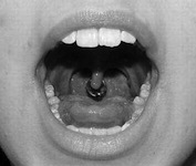 Uvula